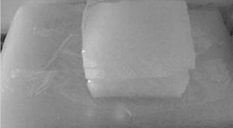 BR是什么？分類品種有哪些